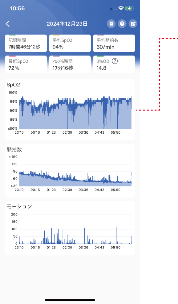 チェックミーリングを指に装着して就寝