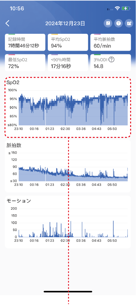 チェックミーリングを指に装着して就寝